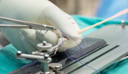 Anterior-Cruciate-Ligament-reconstruction